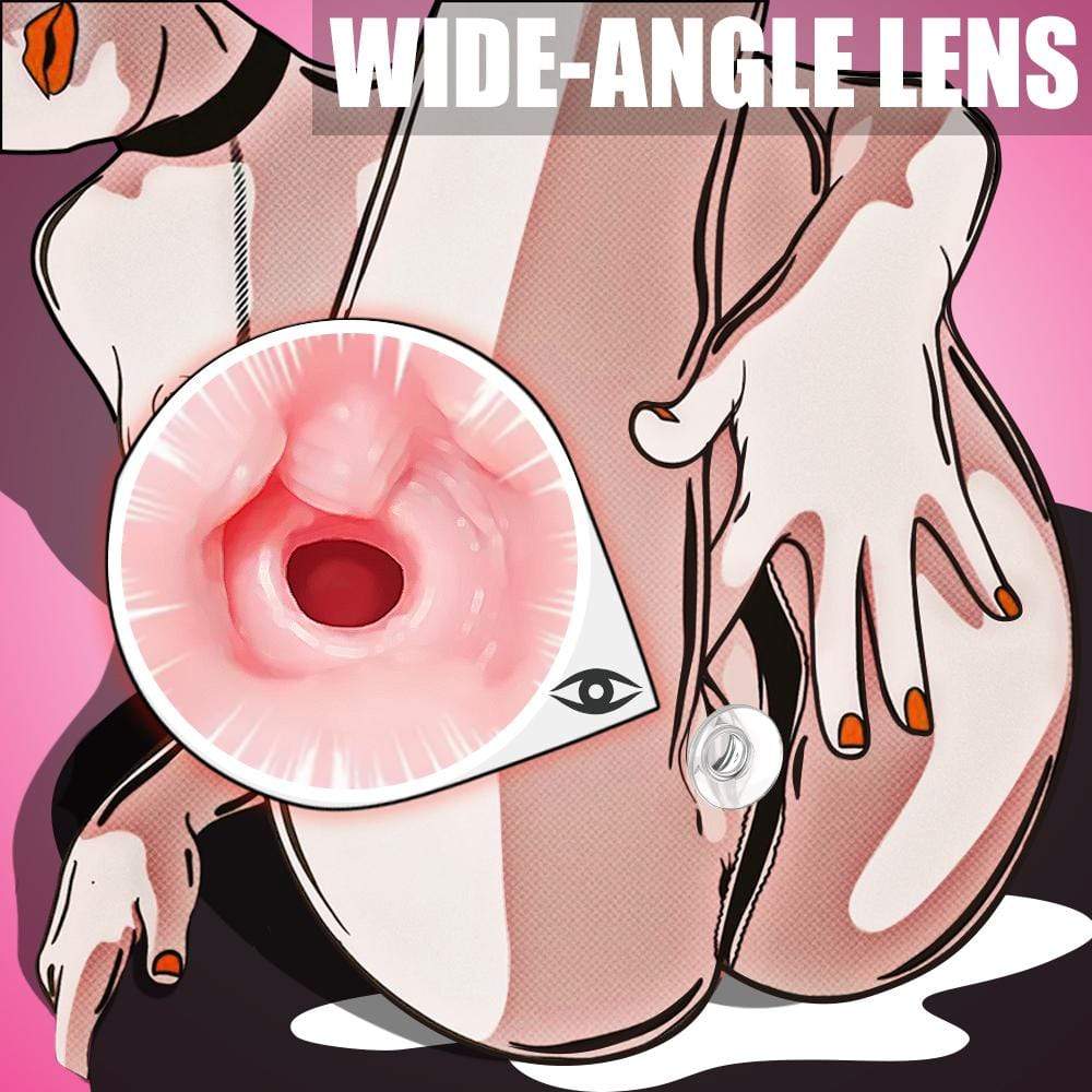 S249 Kit de formation anale transparent