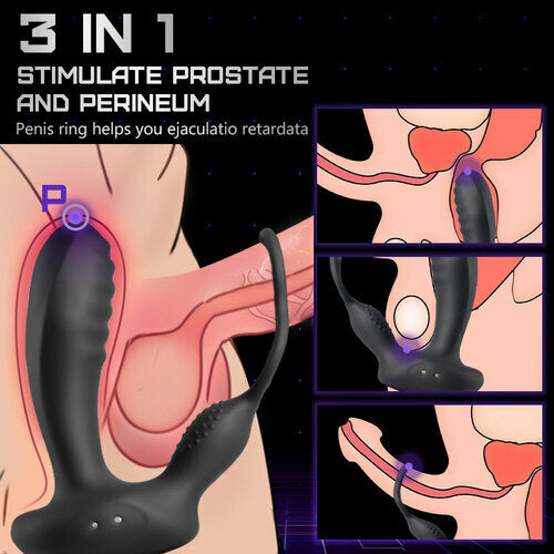 10 Vibrating Smart Heated Multifunctional Prostate Massager with Dual Cock Rings